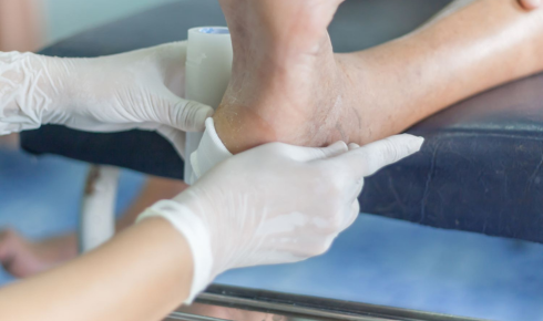 Chronic foot ulcers